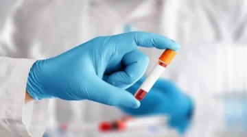 أسعار فحص وظائف الكلى 2026.. إرشادات أساسية قبل الإجراء